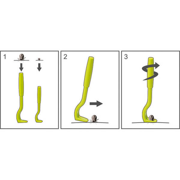Slikovni prikaz odstranitve klopa